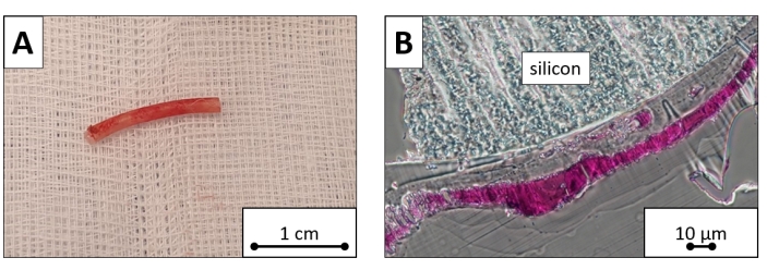 figure-results-8 Silicon stent on gauze (A); microscopic silicon-tissue interface image (B) with 10 µm scale.