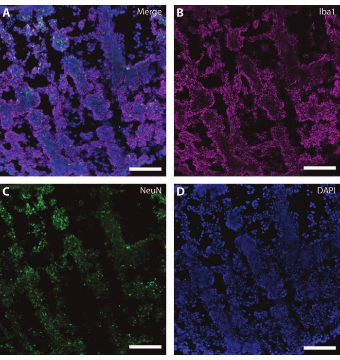 figure-results-7 Fluorescence microscopy of brain tissue; Iba1, NeuN, DAPI stains; cell identification; merge.