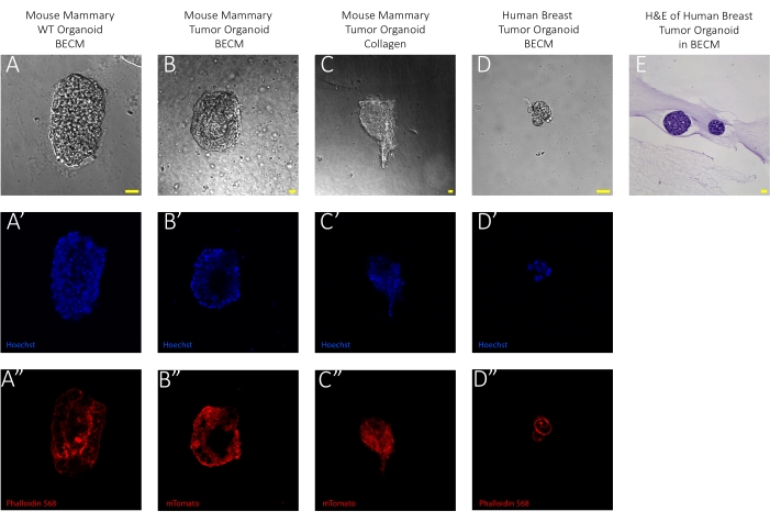 Mouse and human mammary tumor organoid images; microscopy results; Hoechst and Phalloidin staining.