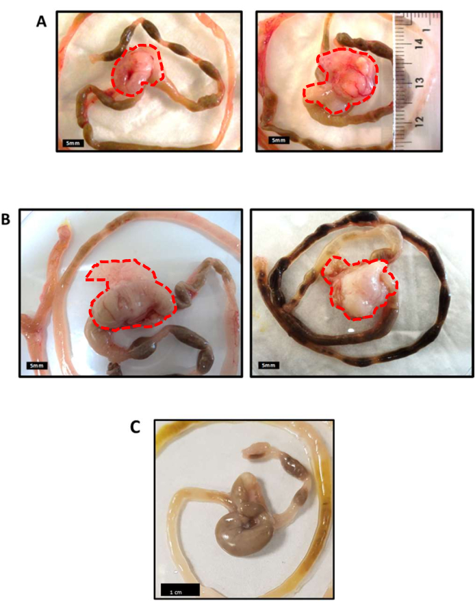 Parasitic worm dissection, anatomical study diagram; biological research, microscopy analysis.