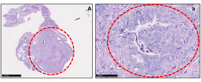 Histology section showing tissue morphology; microscopy, tumor study, cellular structure analysis.
