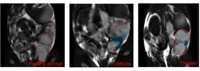 MRI comparison showing tumor in healthy, vehicle, and treated animal models; therapeutic impact analysis.