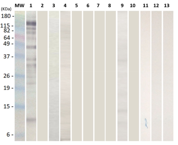 figure-results-3 SDS-PAGE electrophoresis result; protein separation by molecular weight; gel bands; kDa marker.