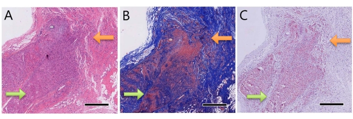 Histology comparison of tissue staining methods, microscope image highlighting cellular structures.
