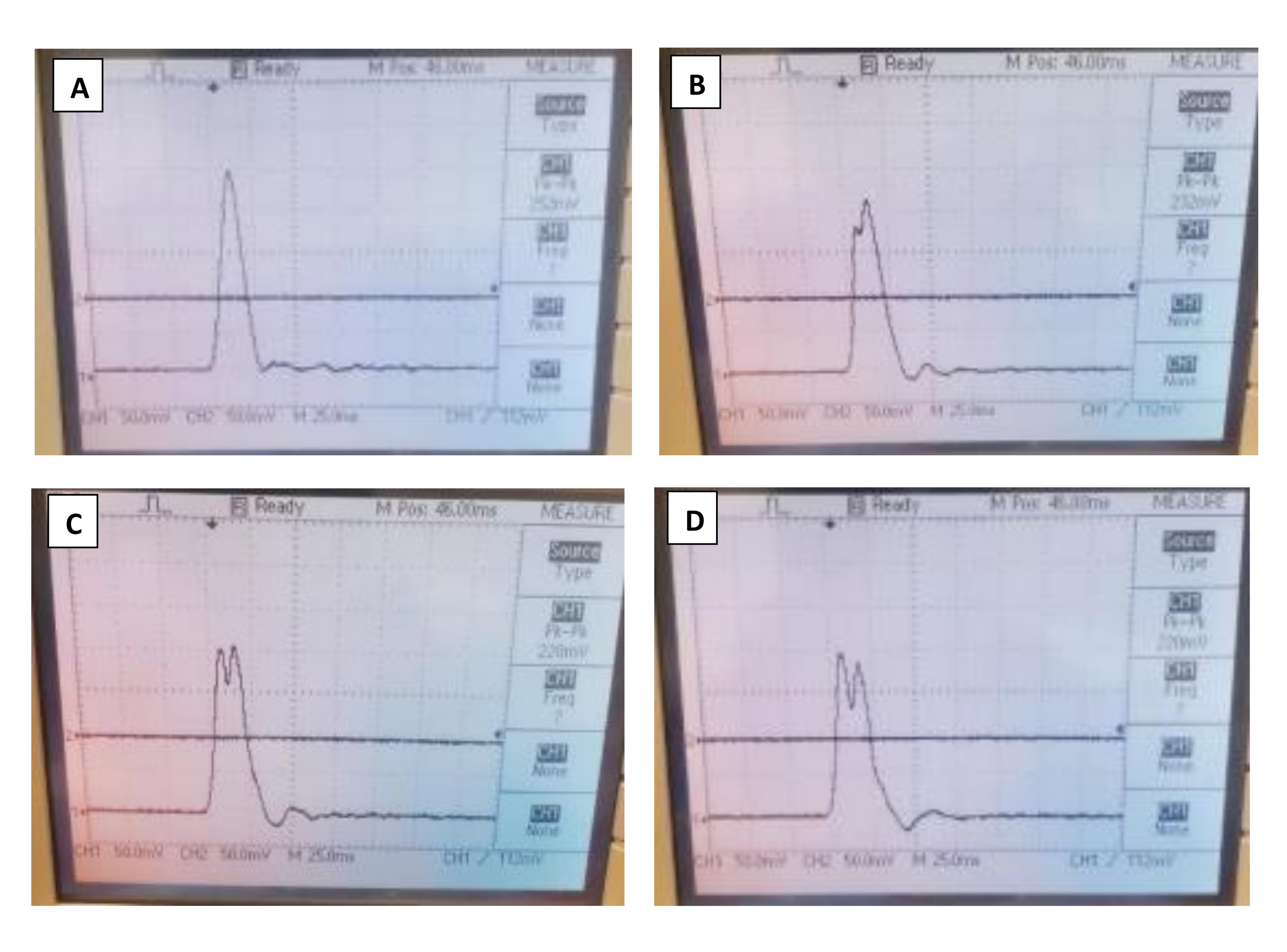 Maintenance of a Lateral Fluid Percussion Injury Device | Protocol ...
