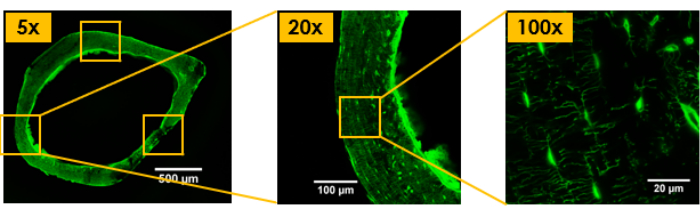 Fluorescence microscopy at 5x, 20x, 100x magnification; tissue structure analysis; green channel.
