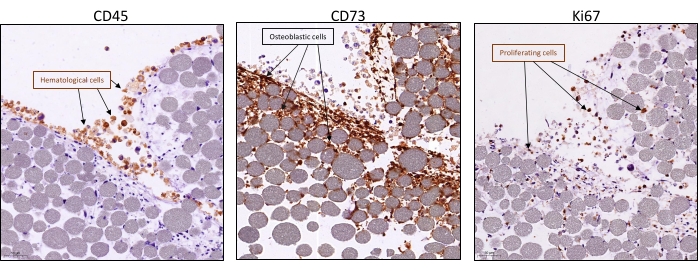 figure-results-3 Immunohistochemistry staining of CD45, CD73, Ki67 in tissue sections showing cell distribution.