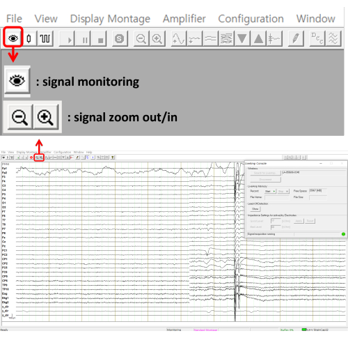 figure-protocol-5 Static equilibrium; EEG signal monitoring interface; signal zoom, waveform analysis graph.