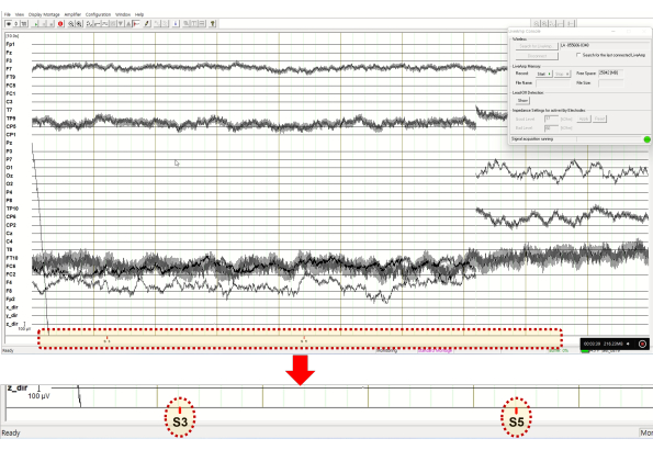 figure-protocol-6 EEG data analysis graph showing brainwave patterns and signal processing for neurological study.