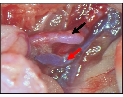 Surgical anatomy, nerve identification, labeled photo, educational research, medical study.