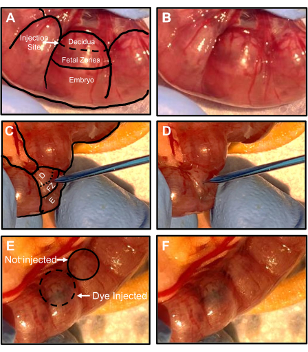 Fetal zone dye injection process; labeled diagram and experimental photography for embryonic study.