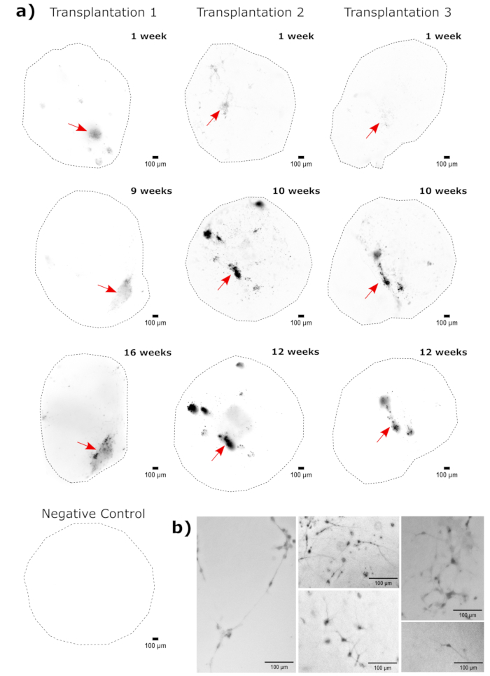 Cell transplantation results showing transplanted cell growth over weeks; microscopy images, 100 µm scale.