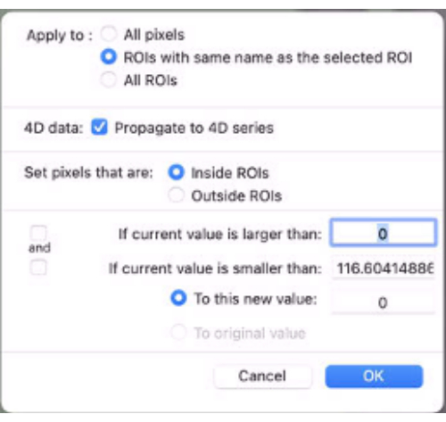 figure-protocol-9 用于4D数据ROI传播、像素值阈值和序列应用选项的设置菜单。