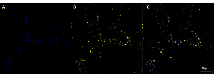 Fluorescence microscopy images showing multicolor labeling of cell structures; A: blue, B: yellow, C: merge.