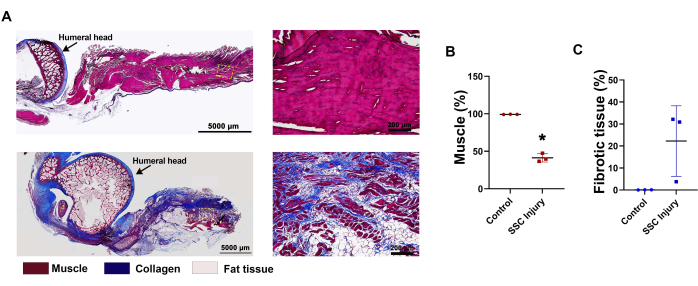 Histological analysis of muscle injury; collagen staining; microscopy images; tissue graph results.
