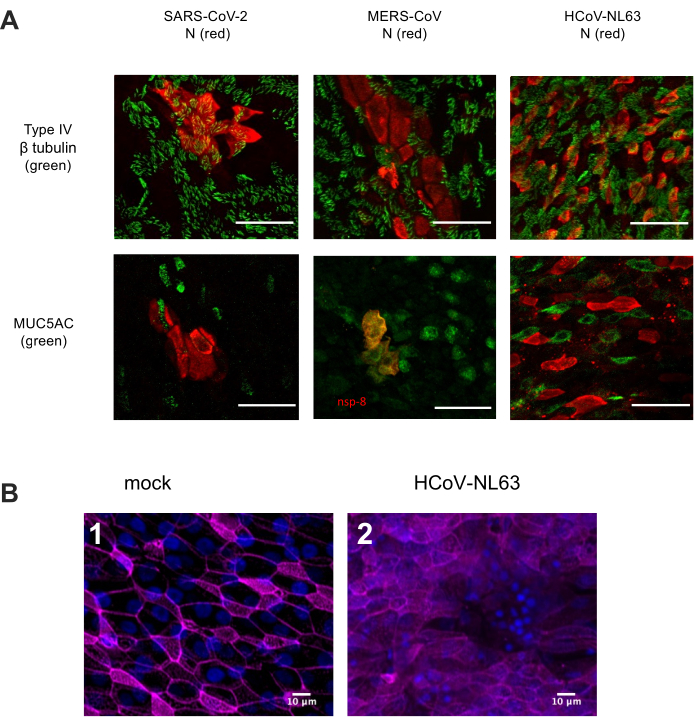 Fluorescence microscopy diagram showing viral protein expression and tubulin alignment in respiratory cells.