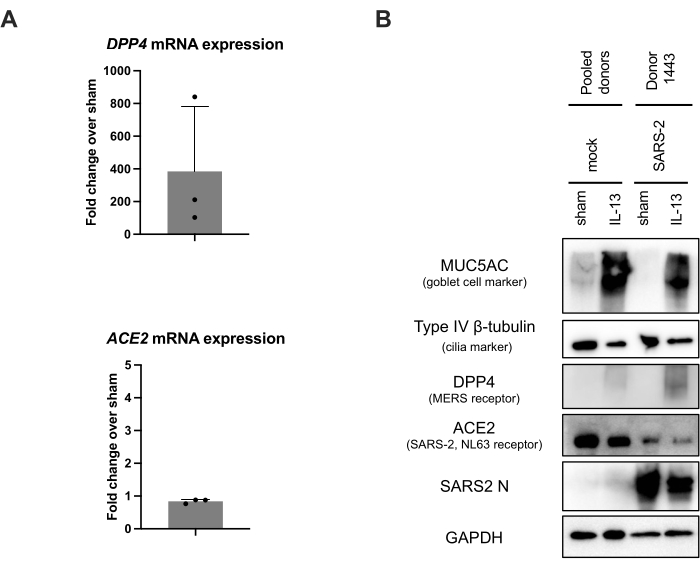 DPP4 and ACE2 expression analysis, bar graph, Western blot, molecular biology experiment results.