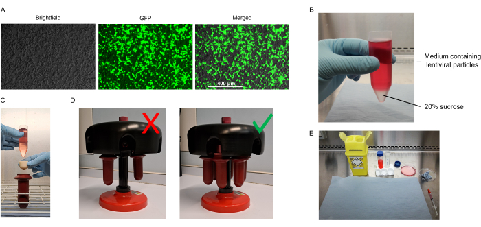 figure-results-1 Lentiviral particle purification: centrifuge method, GFP microscopy, sucrose gradient experiment.