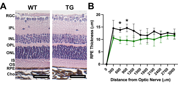 figure-results-4 Histological comparison of retinal layers and graph of RPE thickness; WT vs. TG analysis.