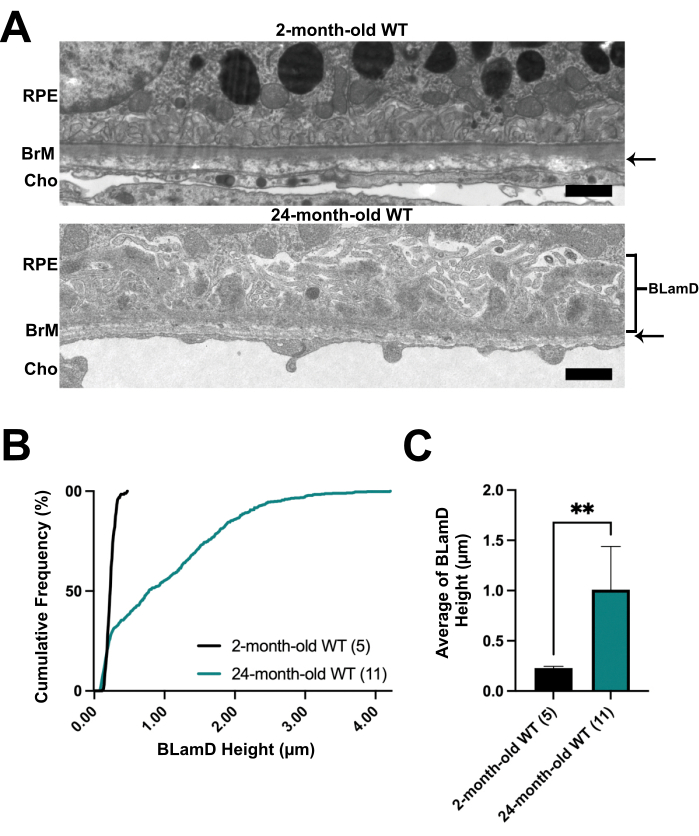 figure-results-6 Electron microscopy of retinal layers shows age-related changes; graphs depict BLamD thickness data.