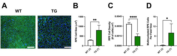 figure-results-7 RPE cell comparison: WT vs TG; microscopy, cell size, density, multinucleation; bar graph results.
