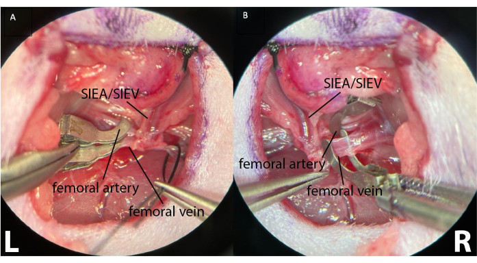 figure-protocol-4 Microscope image of surgical anatomy; SIEA/SIEV, femoral artery, vein; labeled diagram for education.