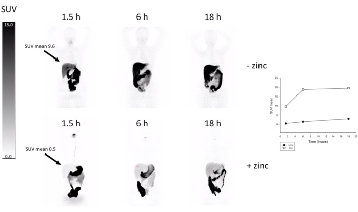 Cu64 Positron Emission Tomography Using 64-Copper as a Tracer for the Study ...