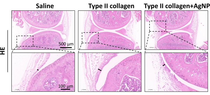 Histological analysis comparing saline, Type II collagen, and AgNP impact; tissue microstructure.