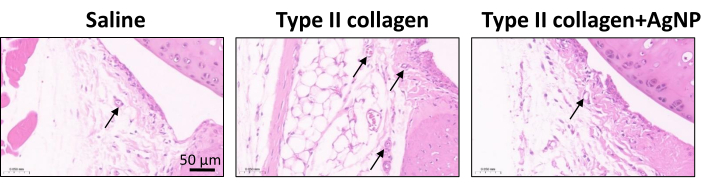 Histology comparison of saline, type II collagen and type II collagen with AgNP; tissue structure analysis.