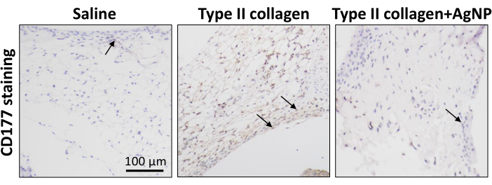 CD177 staining results; saline, Type II collagen, Type II collagen+AgNP; histology comparison.