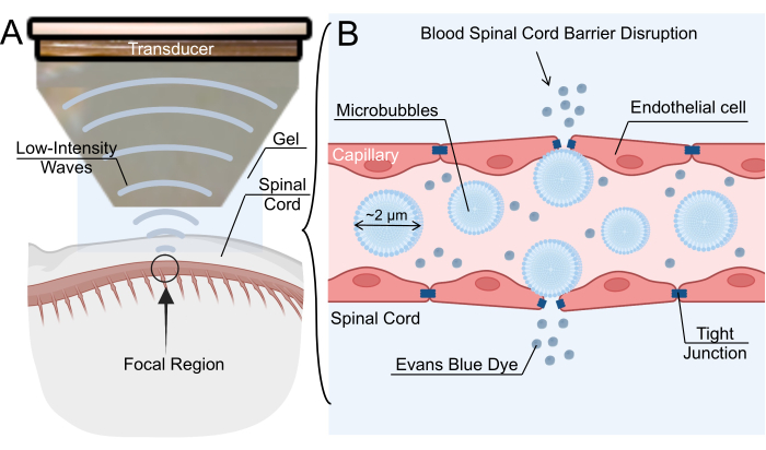 figure-results-1 Ultrasound-induced blood spinal cord barrier disruption diagram with microbubbles for dye delivery.