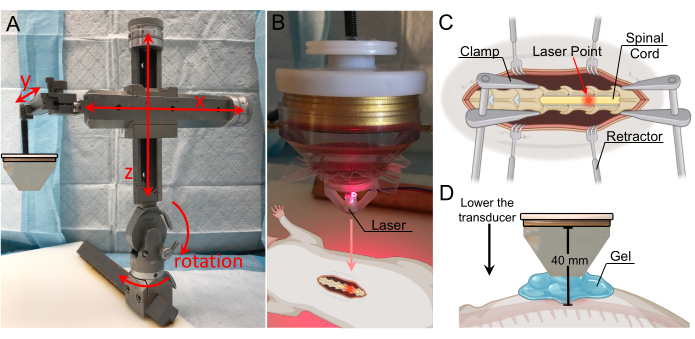 figure-results-3 Laser-guided spinal surgery diagrams; equipment setup, laser targeting, retractor use in medical study.