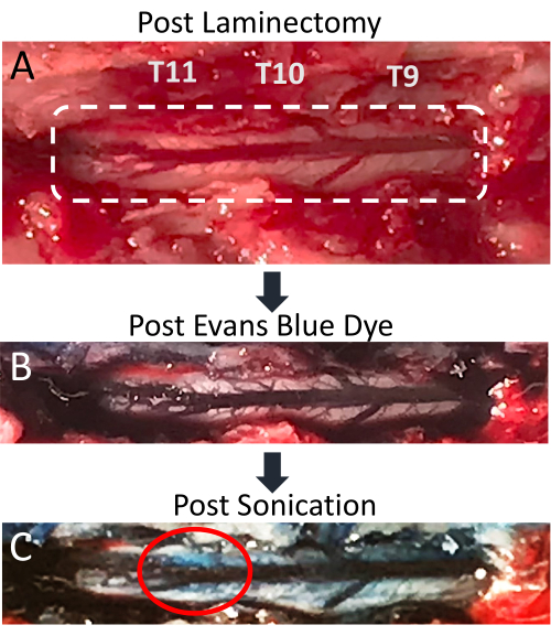 figure-results-4 Post laminectomy dye diffusion in spinal tissue pre-and post-sonication, experimental setup.