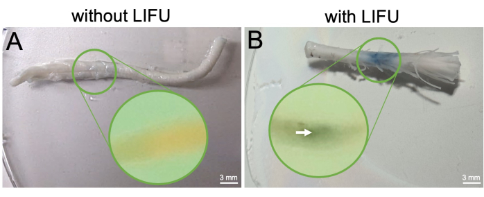 figure-results-5 Tissue sample comparison with and without LIFU treatment; microscope image showing cellular effects.