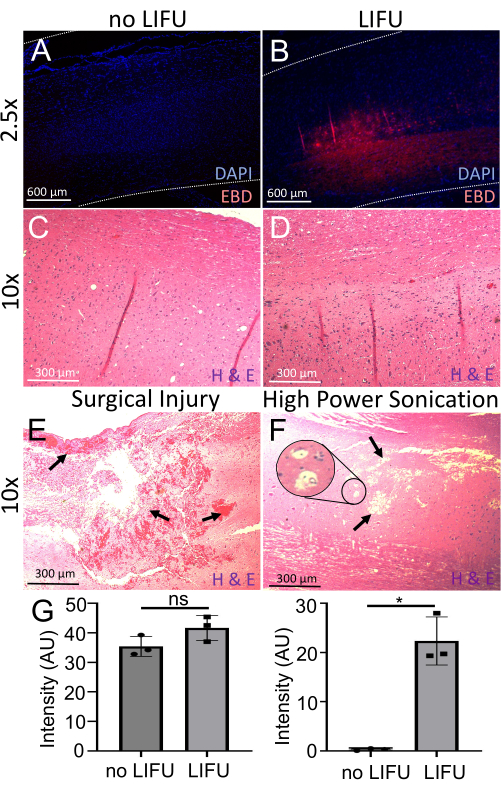 figure-results-6 LIFU effects on rat tissue: DAPI and EBD staining, H&E images, and intensity graphs suggest sonication impact.