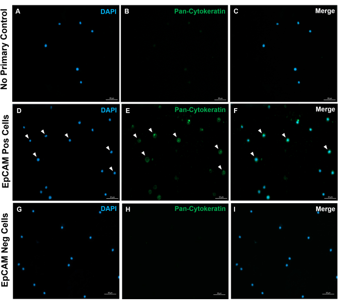 figure-results-10 Immunofluorescence microscopy, DAPI, Pan-Cytokeratin staining, EpCAM cells, control comparison.