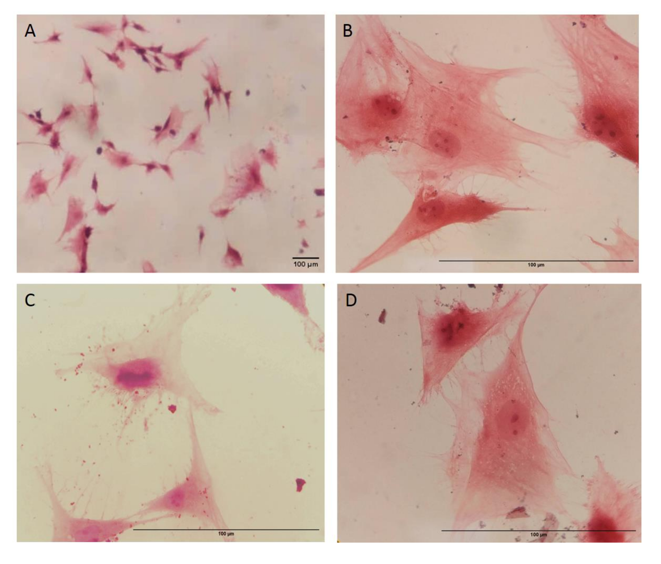 Isolation and Identification of Mesenchymal Stem Cells Derived from ...
