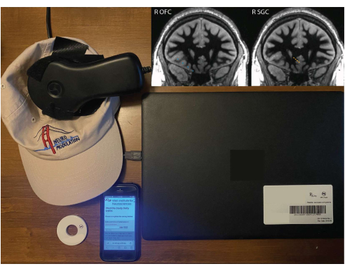 Transcranial magnetic stimulation setup with MRI scans for brain activity analysis and data recording.