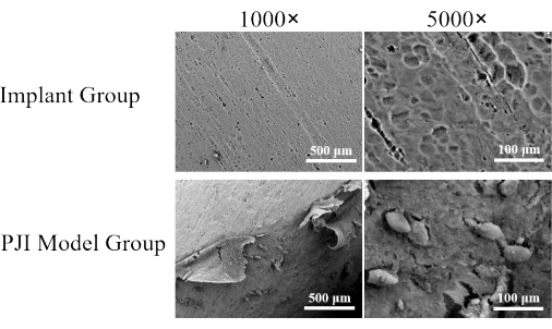 SEM images of implant surfaces at 1000× and 5000× magnification, showing textural differences.