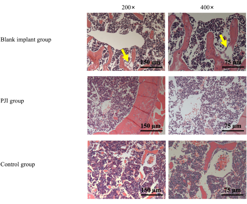Histology comparison of bone tissue: blank implant, PJI, control; 200× and 400× magnifications.