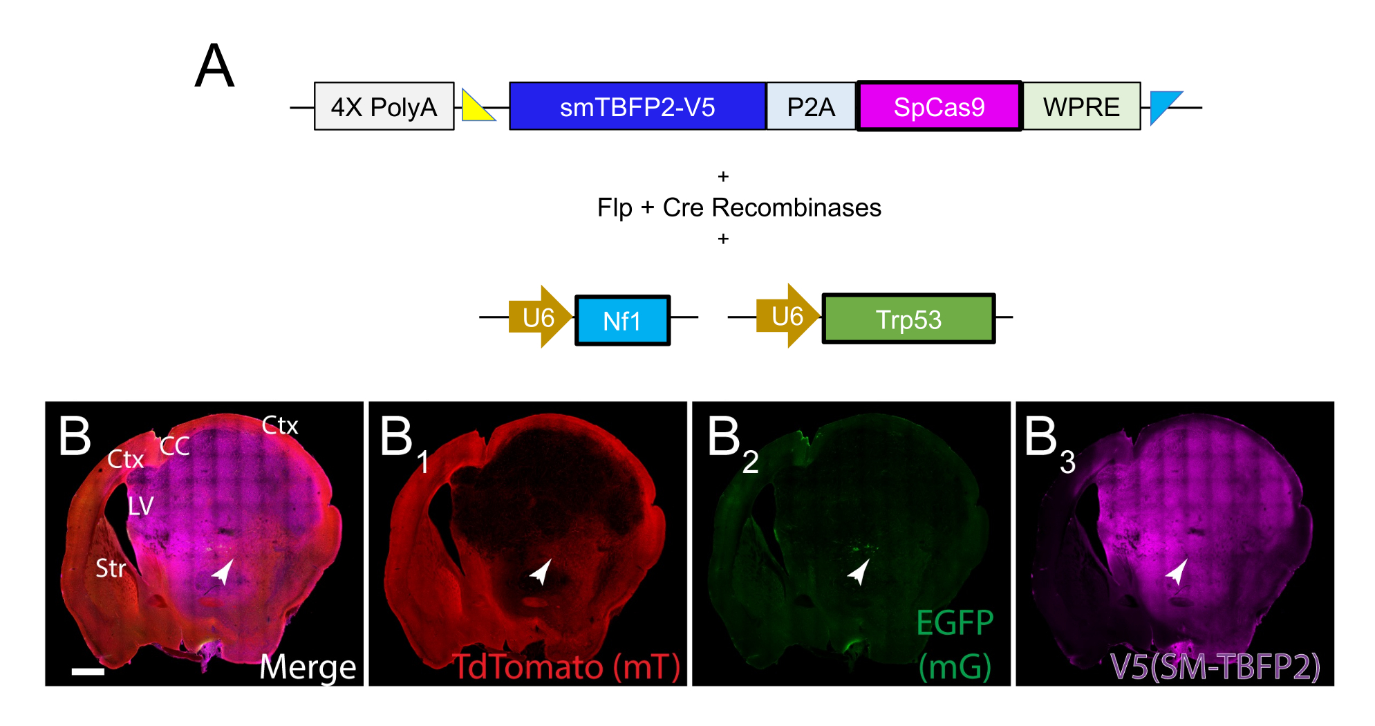Modeling Brain Tumors In Vivo Using Electroporation-Based Delivery of ...