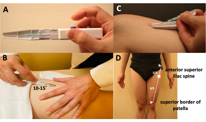 Intramuscular injection technique diagram; thigh injection angle, anatomical landmarks.