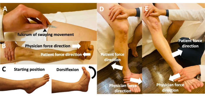 Muscle energy technique process diagram showing physician and patient force directions for leg dorsiflexion.