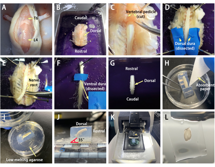 Spinal cord dissection step-by-step; vertebral pedicle, dorsal dura exposure; microscopy setup.