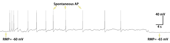 Action potential graph with spontaneous AP spikes, showing RMP at -60 mV and -65 mV; voltage-time data.