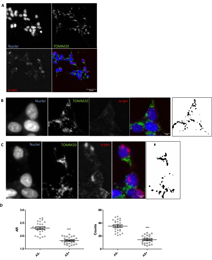 Cellular localization of Nuclei, TOMM20, and α-syn; microscope images, statistical analysis results.