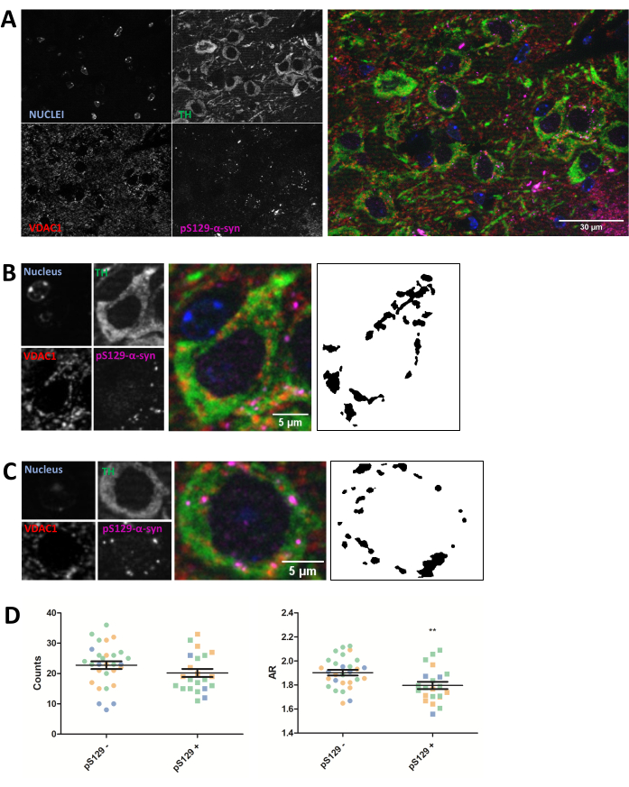 Immunofluorescence showing α-synuclein, TH, VDAC1 in dopaminergic neurons; includes analysis graphs.