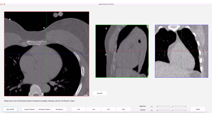 CT scan analysis; cross-sectional images; medical imaging; three-plane view; diagnostic tool.