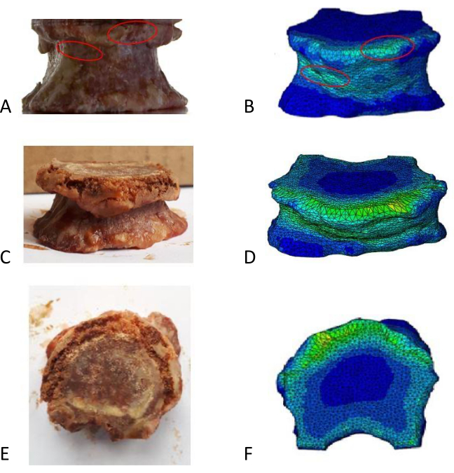 figure-results-6 Porcine spine compression study; vertebra images A, C, E with stress model diagrams B, D, F.