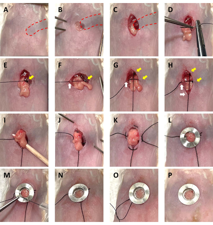figure-results-3 Surgical incision and closure process, step-by-step diagram, with tissue manipulation and suturing.